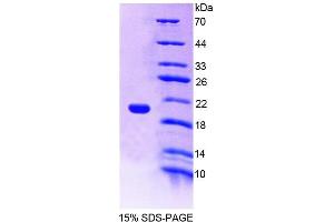 Image no. 1 for Neuropilin 1 (NRP1) (AA 646-814) protein (His tag) (ABIN1080363) (Neuropilin 1 Protein (NRP1) (AA 646-814) (His tag))