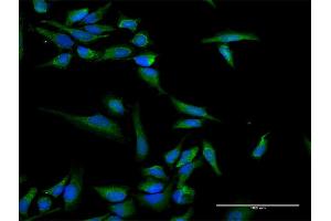 Immunofluorescence of purified MaxPab antibody to INPP5B on HeLa cell. (INPP5B antibody  (AA 1-748))