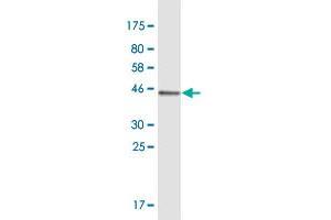 Western Blot detection against Immunogen (40. (Msx2/Hox8 antibody  (AA 1-133))