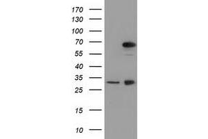 HEK293T cells were transfected with the pCMV6-ENTRY control (Left lane) or pCMV6-ENTRY MPP3 (Right lane) cDNA for 48 hrs and lysed. (MPP3 antibody)