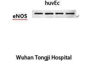 Western Blot (WB) analysis: Please contact us for more details. (ENOS antibody)