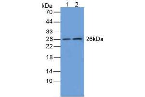 Figure. (GSTM1 antibody  (AA 1-218))