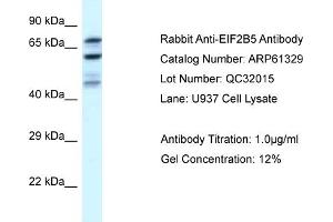 Western Blotting (WB) image for anti-Eukaryotic Translation Initiation Factor 2B, Subunit 5 Epsilon, 82kDa (EIF2B5) (N-Term) antibody (ABIN786396) (EIF2B5 antibody  (N-Term))