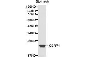 Western Blotting (WB) image for anti-Cysteine and Glycine-Rich Protein 1 (CSRP1) antibody (ABIN1872045)