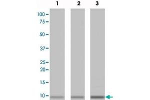 Western blot analysis of recombinant Metallothionein protein with Metallothionein monoclonal antibody, clone N11-G . (MT1A antibody  (N-Term))
