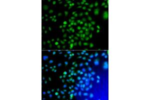 Immunofluorescence analysis of A549 cell using ATF7 antibody. (AFT7 antibody)