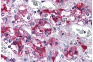 Human Adrenal: Formalin-Fixed, Paraffin-Embedded (FFPE) (RIMS2 antibody  (C-Term))
