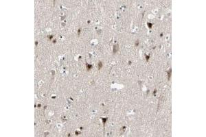 Immunohistochemical staining (Formalin-fixed paraffin-embedded sections) of human cerebral cortex with MARK1 polyclonal antibody  shows strong nuclear and cytoplasmic positivity in neuronal cells at 1:20-1:50 dilution. (MARK1 antibody)