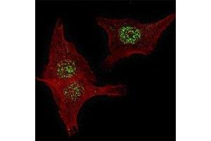 Immunofluorescence (IF) image for anti-Fibroblast Growth Factor Receptor 4 (FGFR4) (AA 24-55) antibody (ABIN3030958)