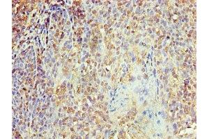 Immunohistochemistry of paraffin-embedded human tonsil tissue using ABIN7156126 at dilution of 1:100 (KPNA1 antibody  (AA 8-538))