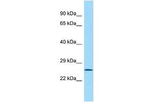 WB Suggested Anti-LAIR1 Antibody Titration: 1. (LAIR1 antibody  (C-Term))