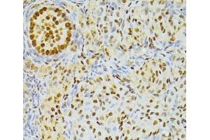 Immunohistochemistry of paraffin-embedded Rat ovary using ALYREF Polyclonal Antibody at dilution of 1:100 (40x lens). (THO Complex 4 antibody)