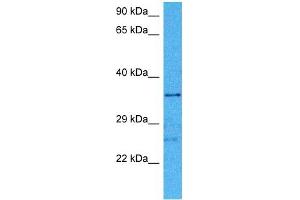 Host:  Mouse  Target Name:  HIF1AN  Sample Tissue:  Mouse Brain  Antibody Dilution:  1ug/ml (HIF1AN antibody  (Middle Region))