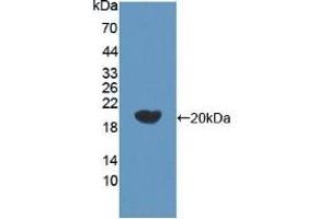 Detection of Recombinant bACE2, Human using Polyclonal Antibody to Beta Secretase 2 (BACE2) (BACE2 antibody  (AA 230-396))
