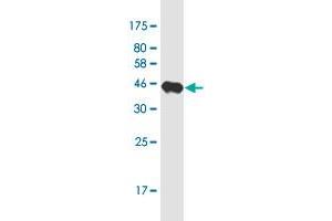 Western Blot detection against Immunogen (37. (PCDH11X antibody  (AA 1228-1336))