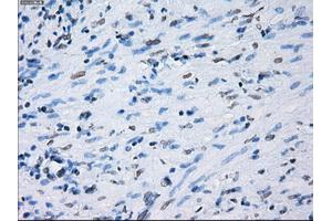 Immunohistochemical staining of paraffin-embedded Ovary tissue using anti-PSMA7mouse monoclonal antibody.