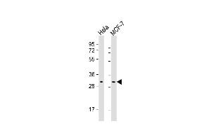 Lane 1: HeLa Cell lysates, Lane 2: MCF-7 Cell lysates, probed with RAB20 (1694CT210. (RAB20 antibody)