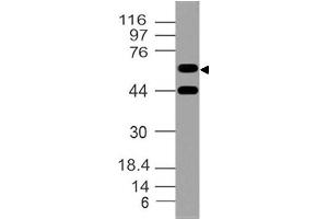 Image no. 1 for anti-SWAP Switching B-Cell Complex 70kDa Subunit (SWAP70) (AA 1-203) antibody (ABIN5027553) (SWAP70 antibody  (AA 1-203))