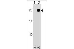 Western blot analysis of ULBP2 (arrow) using rabbit polyclonal ULBP2 Antibody (Center) (ABIN1538674 and ABIN2848734). (ULBP2 antibody  (AA 88-116))