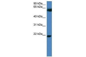 Western Blot showing FBXO32 antibody used at a concentration of 1-2 ug/ml to detect its target protein. (FBXO32 antibody  (N-Term))