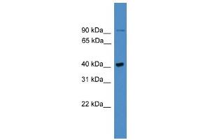 WB Suggested Anti-UBXN6 Antibody Titration: 0. (UBXN6 antibody  (C-Term))