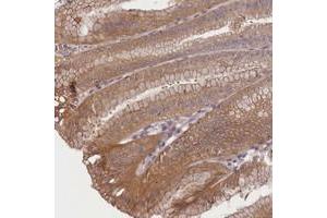 Immunohistochemical staining of human stomach with TMEM39A polyclonal antibody  shows moderate cytoplasmic positivity in glandular cells at 1:10-1:20 dilution.