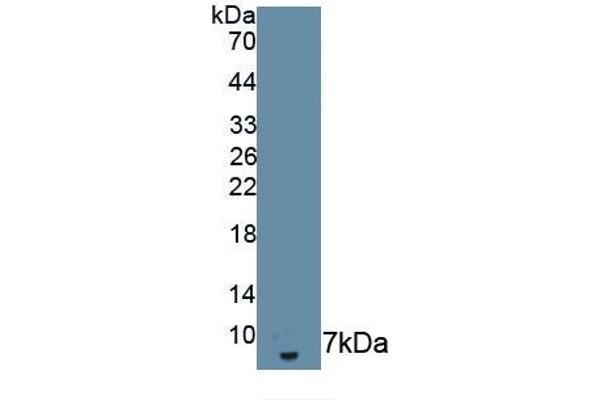 IL18R1 anticorps  (AA 375-428)