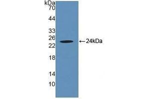 Detection of Recombinant CRYaB, Human using Polyclonal Antibody to Crystallin Alpha B (CRYaB) (CRYAB antibody  (AA 1-175))