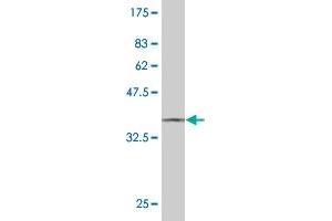 Western Blot detection against Immunogen (37. (STYK1 antibody  (AA 50-159))