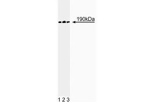 Western blot analysis of p190-B on a A431 cell lysate (Human epithelial carcinoma, ATCC CRL-1555). (ARHGAP5 antibody  (AA 1102-1214))