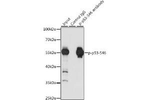 Immunoprecipitation (IP) image for anti-Tumor Protein P53 (TP53) (pSer46) antibody (ABIN6136162)