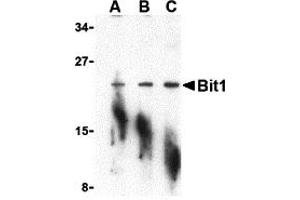 Western Blotting (WB) image for anti-Peptidyl-tRNA Hydrolase 2 (PTRH2) (N-Term) antibody (ABIN1031275) (PTRH2 antibody  (N-Term))