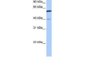 WB Suggested Anti-DEPDC7 Antibody Titration:  0.