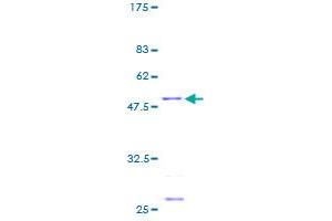 Image no. 1 for Mitochondrial Ribosomal Protein S23 (MRPS23) (AA 1-190) protein (GST tag) (ABIN1311370) (MRPS23 Protein (AA 1-190) (GST tag))