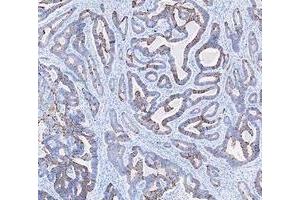 IHC analysis of Cytokeratin 20/Krt20 using anti-Cytokeratin 20/Krt20 antibody (ABIN7601133). (KRT20 antibody  (AA 29-431))