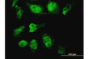 Immunofluorescence of monoclonal antibody to HOXD11 on HeLa cell. (HOXD11 antibody  (AA 1-76))