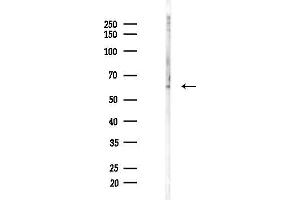 Western blot analysis of lysates from A2780 cells(UV,30 min treatment), using Phospho-hnRNP K (Ser216) Antibody at 1/1000 dilution.