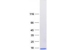 Validation with Western Blot (S100A3 Protein (Myc-DYKDDDDK Tag))