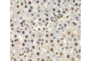 Immunohistochemistry of paraffin-embedded Rat liver using TOR1A Polyclonal Antibody at dilution of 1:200 (40x lens). (TOR1A antibody)