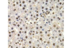 Immunohistochemistry of paraffin-embedded Rat liver using TOR1A Polyclonal Antibody at dilution of 1:200 (40x lens).