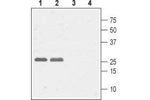 Western blot analysis of rat (lanes 1 and 3) and mouse (lanes 2 and 4) brain lysates: - 1,2. (CACNG5 antibody  (1st Extracellular Loop))