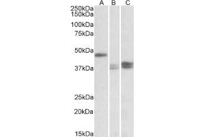 AP23763PU-N TXNDC5 antibody staining of Mouse Lymph Nodes (A), Stomach (B) and Intestine (C) lysates at 0. (TXNDC5 antibody  (Internal Region))