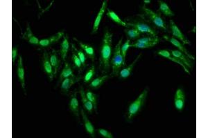 Immunofluorescence staining of Hela cells with ABIN7169262 at 1:333, counter-stained with DAPI. (PPP2R4 antibody  (AA 1-250))