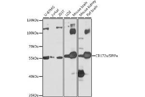 Western blot analysis of extracts of various cell lines, using CD172a/SIRPα antibody (ABIN6130058, ABIN6147780, ABIN6147781 and ABIN6224854) at 1:1000 dilution. (SIRPA antibody  (AA 395-504))
