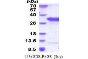 TSR2, 20S rRNA Accumulation, Homolog (TSR2) (AA 1-190) protein (His tag)
