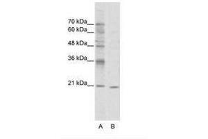 Image no. 1 for anti-Visual System Homeobox 1 (VSX1) (N-Term) antibody (ABIN202105) (VSX1 antibody  (N-Term))