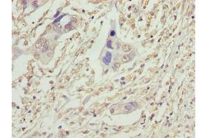 Immunohistochemistry (IHC) image for anti-Vacuolar Protein-Sorting-Associated Protein 25 (VPS25) (AA 1-176) antibody (ABIN7175336)