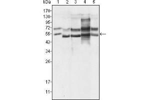 Western Blot showing using GABPA antibody used against Hela (1), A549 (2), MCF-7 (3), NIH/3T3 (4) and SMMC-7721 (5) cell lysate.