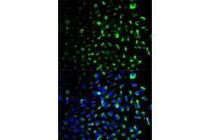 Immunofluorescence analysis of U2OS cells using HK1 antibody (ABIN5970413). (Hexokinase 1 antibody)