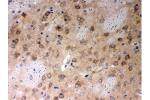Anti- PP2A-alpha Picoband antibody, IHC(P) IHC(P): Rat Brain Tissue (PPP2CA antibody  (AA 1-309))